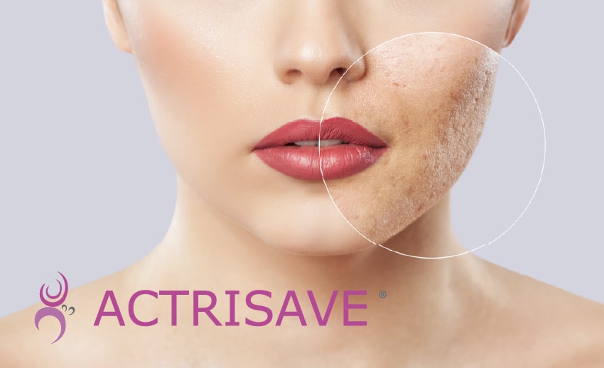 Afbeelding productoptie